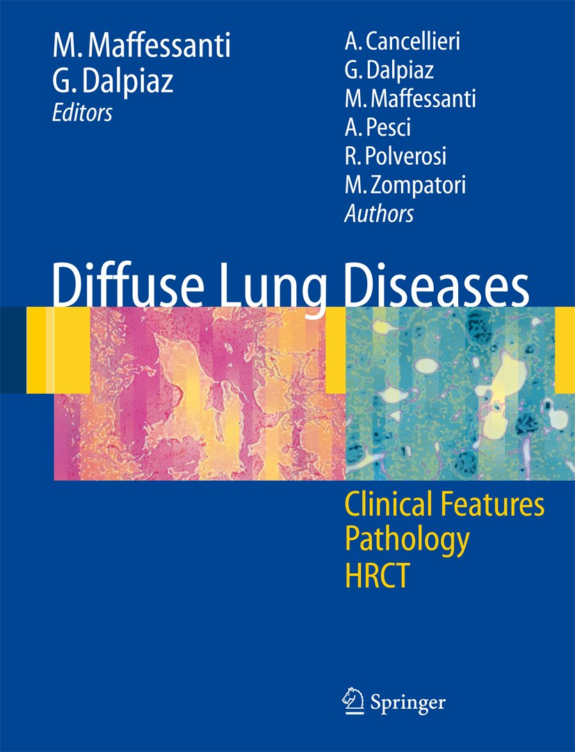 Diffuse Lung Diseases: Clinical Features， Pathology， HRCT [ペーパーバック] Maffessanti， Mario、 Dalpiaz， Giorgia、 Polverosi， R.、 Zompatori， M.、 Pesci， A.; Cancellieri， A. Diffuse Lung Diseases: Clinical Features, Pathology, HRCT – Late