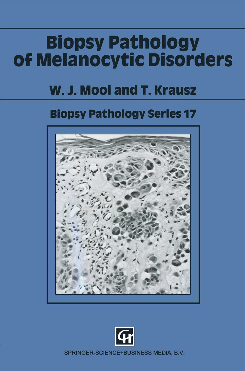 Biopsy Pathology of Melanocytic Disorders