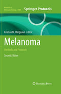 Melanoma