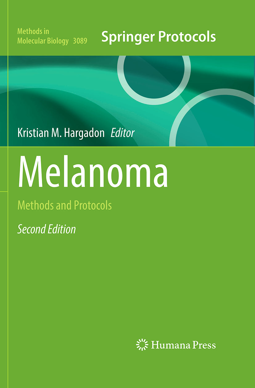 Melanoma