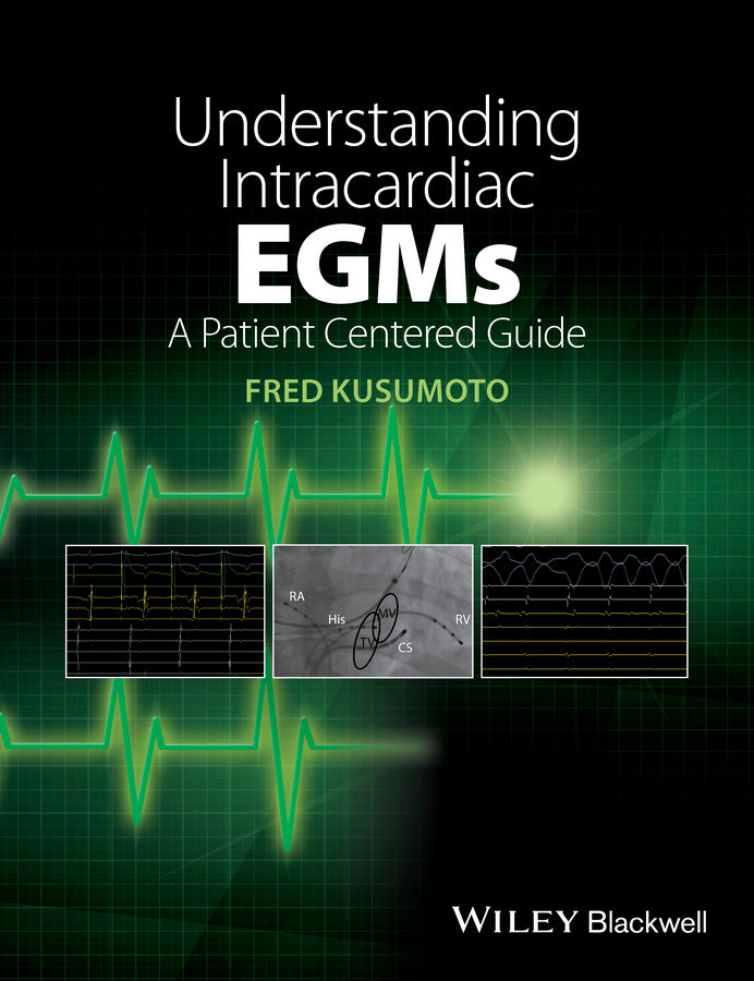 Understanding Intracardiac EGMs