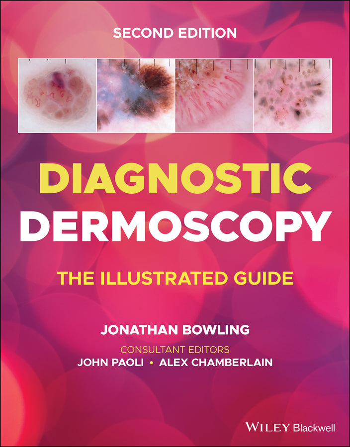 Diagnostic Dermoscopy