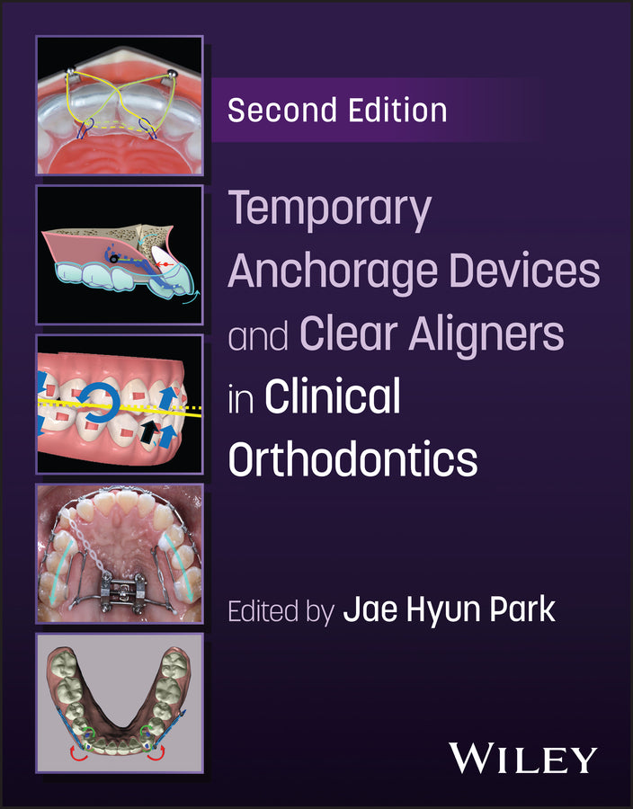 Temporary Anchorage Devices and Clear Aligners in Clinical Orthodontics