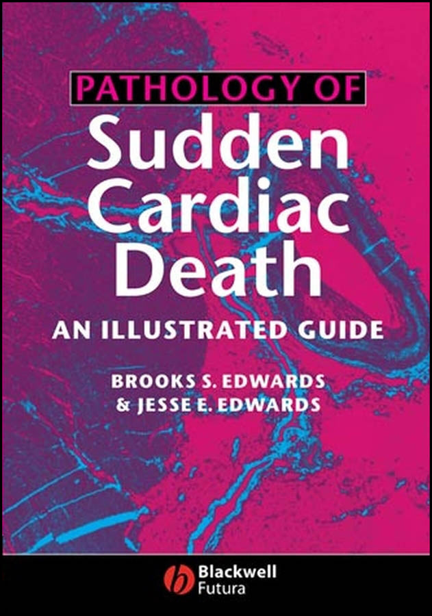 Pathology of Sudden Cardiac Death