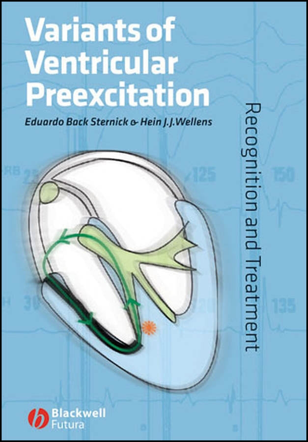 Variants of Ventricular Preexcitation