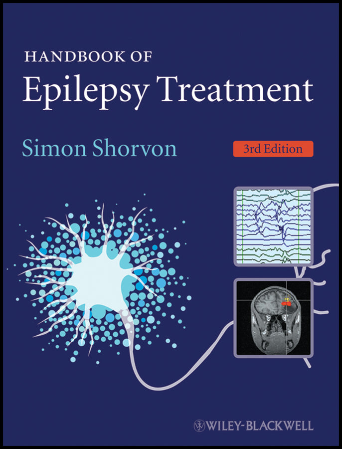 Handbook of Epilepsy Treatment