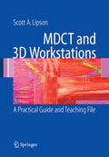 MDCT and 3D Workstations