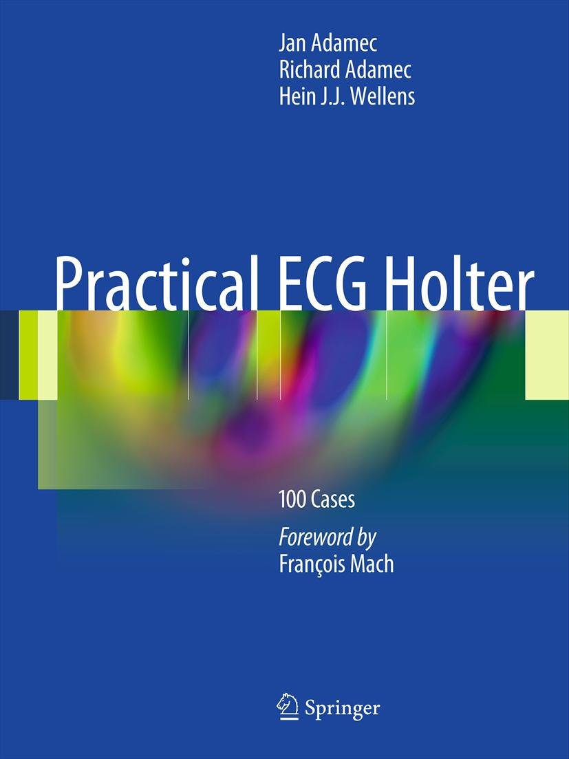Practical ECG Holter