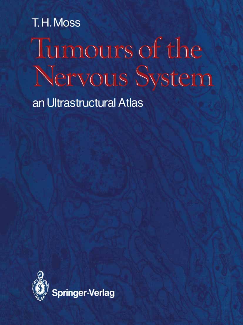 Tumours of the Nervous System