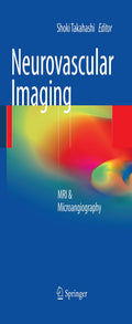 Neurovascular Imaging