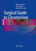 Surgical Guide to Circumcision