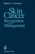 Skin Cancer
