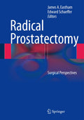 Radical Prostatectomy