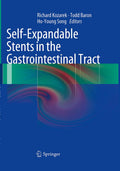 Self-Expandable Stents in the Gastrointestinal Tract