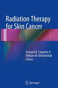 Radiation Therapy for Skin Cancer