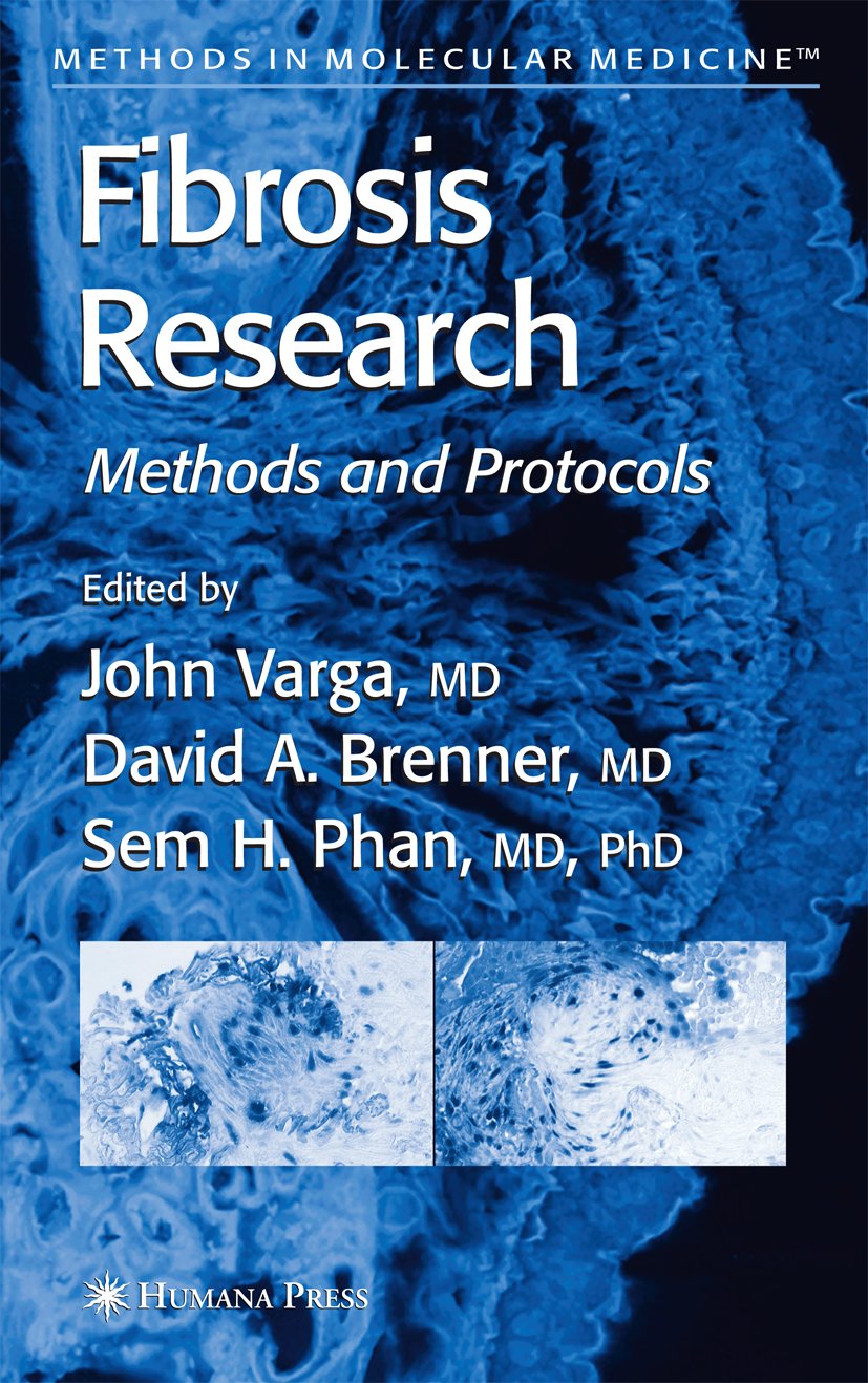 Methods in Molecular Medicine