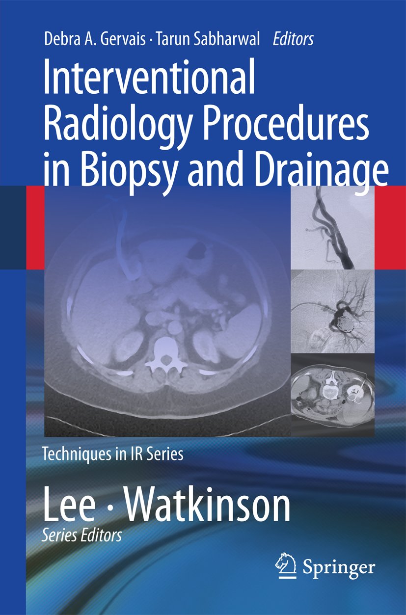 Techniques in Interventional Radiology