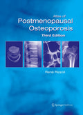 Atlas of Postmenopausal Osteoporosis