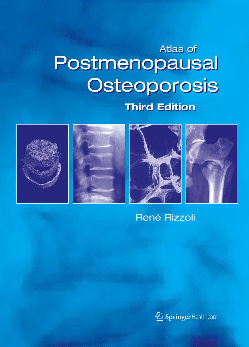 Atlas of Postmenopausal Osteoporosis