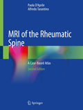 MRI of the Rheumatic Spine
