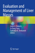 Evaluation and Management of Liver Masses