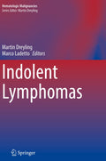 Hematologic Malignancies