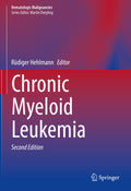 Hematologic Malignancies