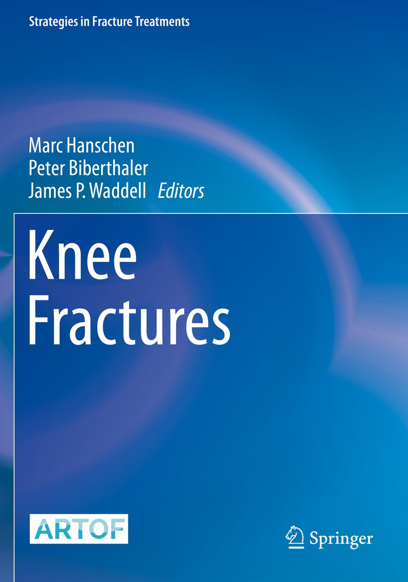 Strategies in Fracture Treatments