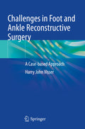 Challenges in Foot and Ankle Reconstructive Surgery
