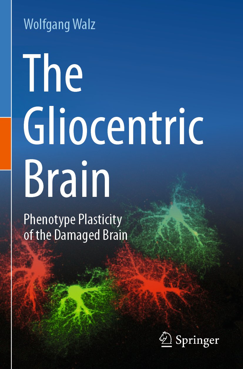 The Gliocentric Brain
