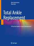 Total Ankle Replacement