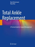 Total Ankle Replacement