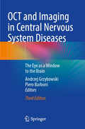 OCT and Imaging in Central Nervous System Diseases