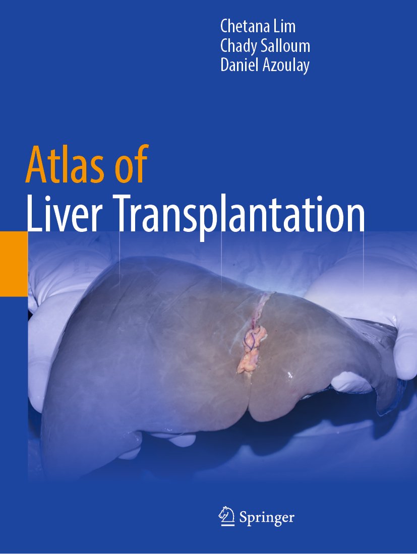 Atlas of Liver Transplantation