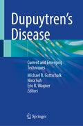Dupuytren's Disease