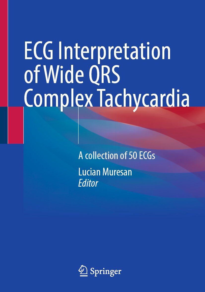 ECG Interpretation of Wide QRS Complex Tachycardia