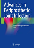 Advances in Periprosthetic Joint Infection