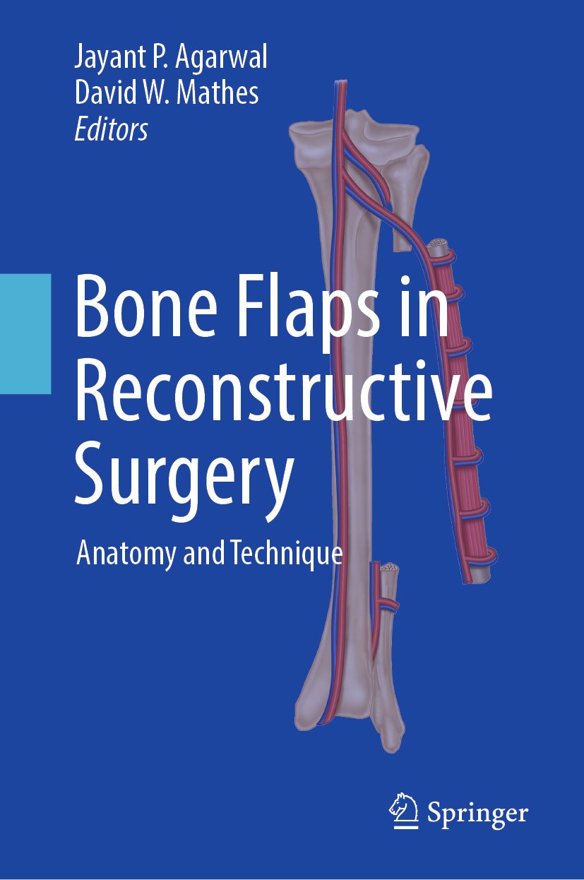 Bone Flaps in Reconstructive Surgery