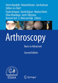 Arthroscopy