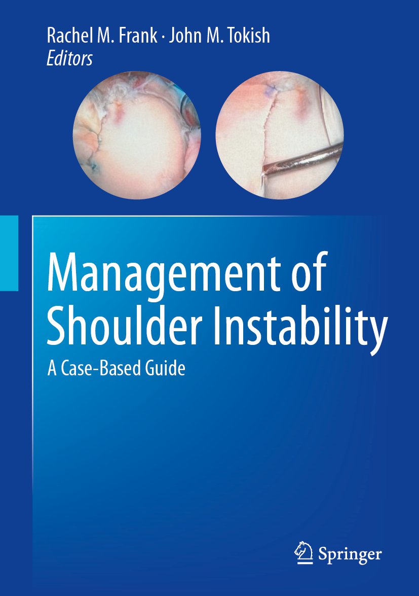 Management of Shoulder Instability