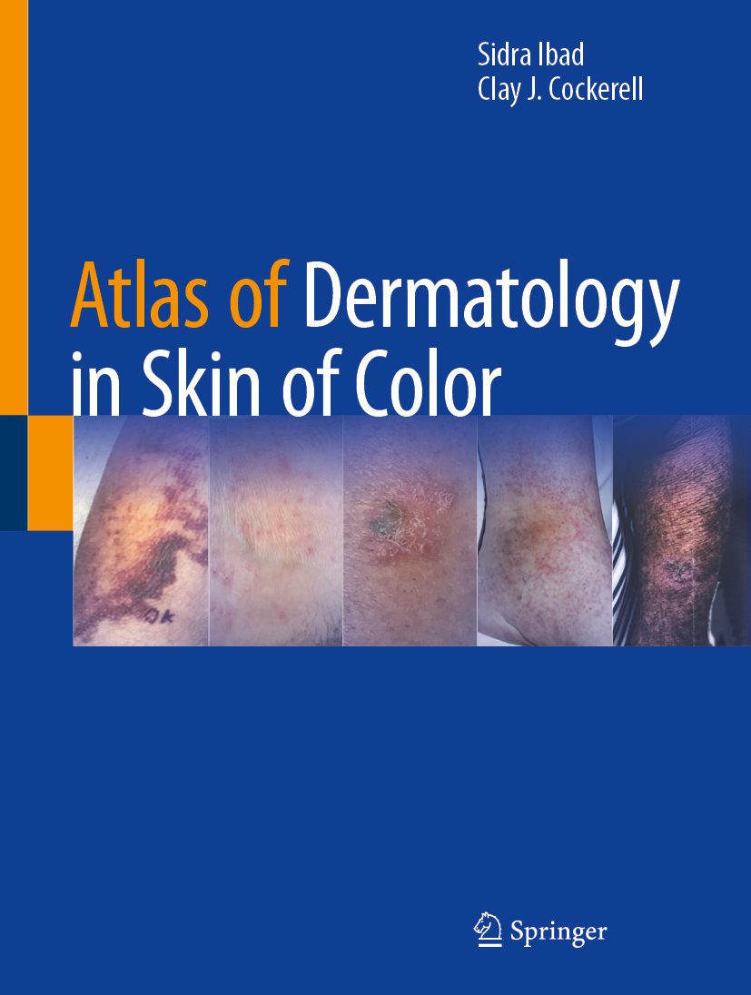 Atlas of Dermatology in Skin of Color