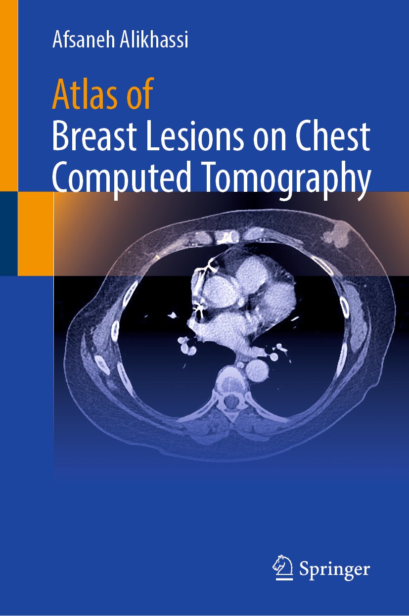 Atlas of Breast Lesions on Chest Computed Tomography