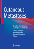 Cutaneous Metastases