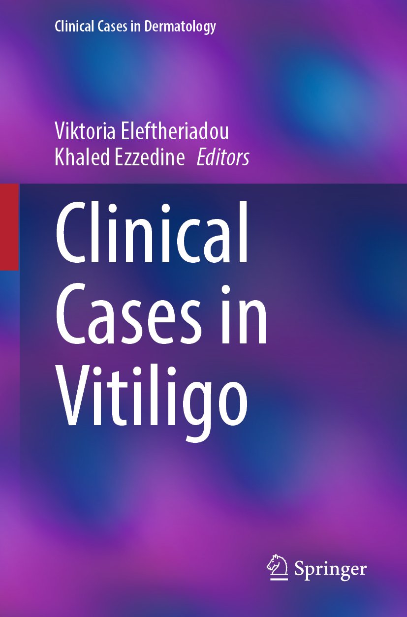 Clinical Cases in Vitiligo
