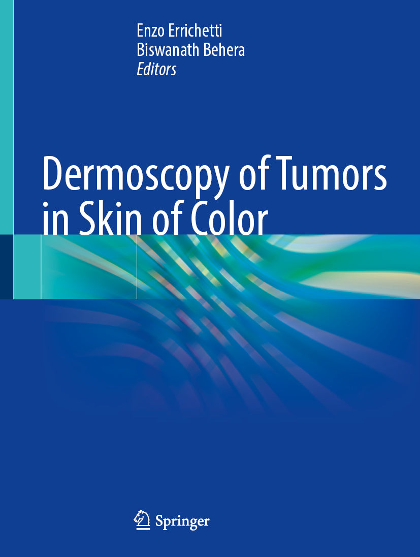 Dermoscopy of Tumors in Skin of Color