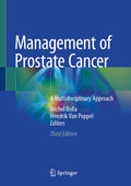Management of Prostate Cancer
