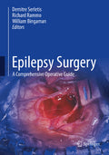 Epilepsy Surgery