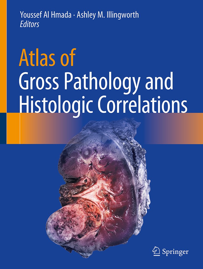 Atlas of Gross Pathology and Histologic Correlations