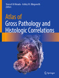 Atlas of Gross Pathology and Histologic Correlations
