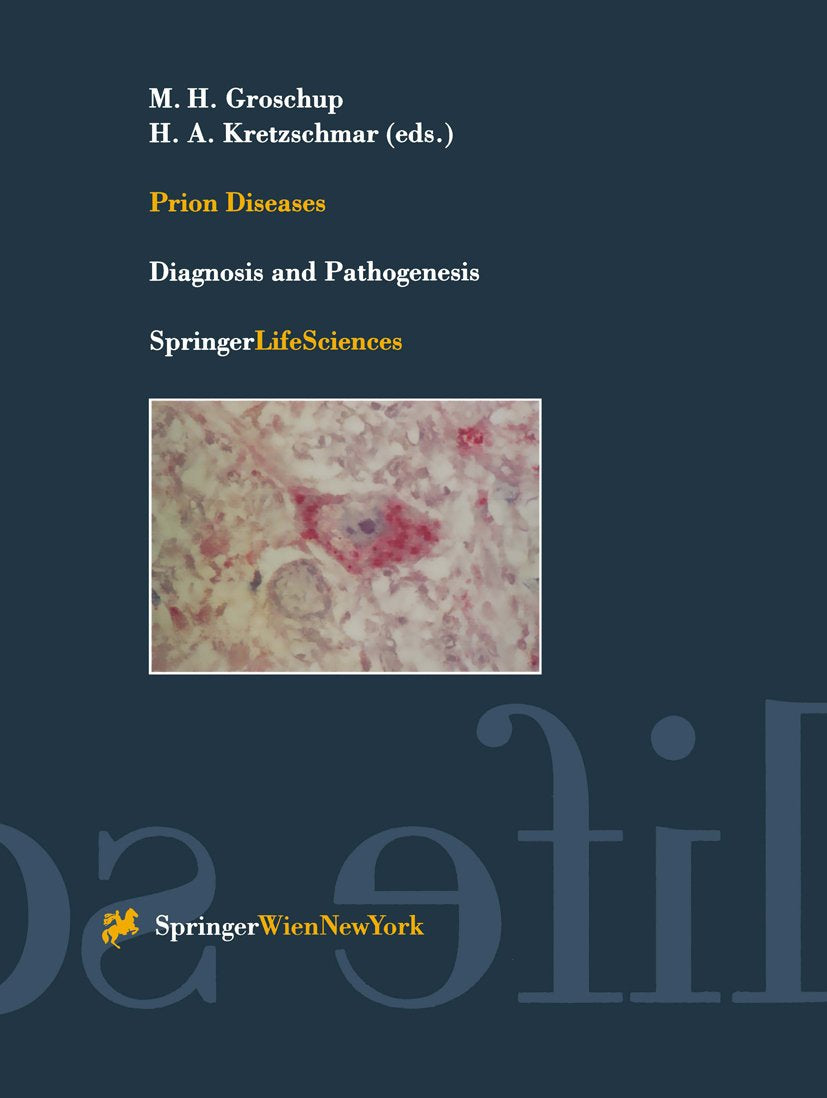 Prion Diseases